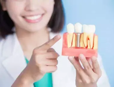 Implante Dentário: o que você não pode deixar de saber sobre esse procedimento