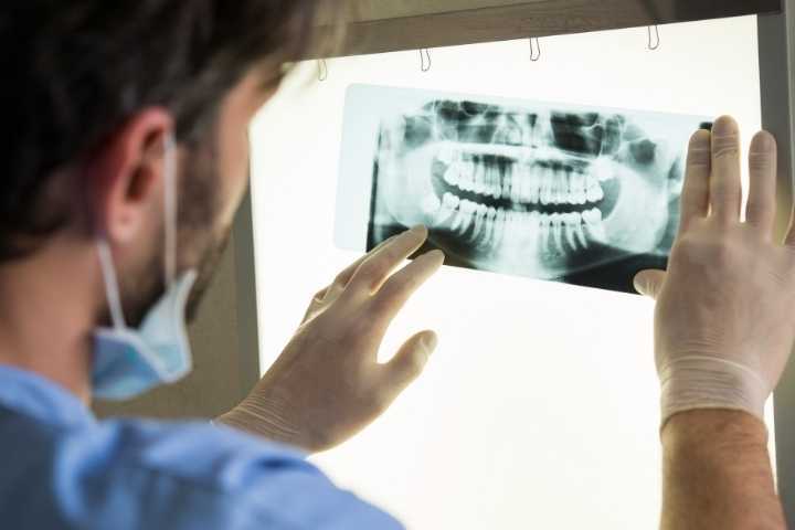 Quais são os exames necessários para fazer um Implante Dentário