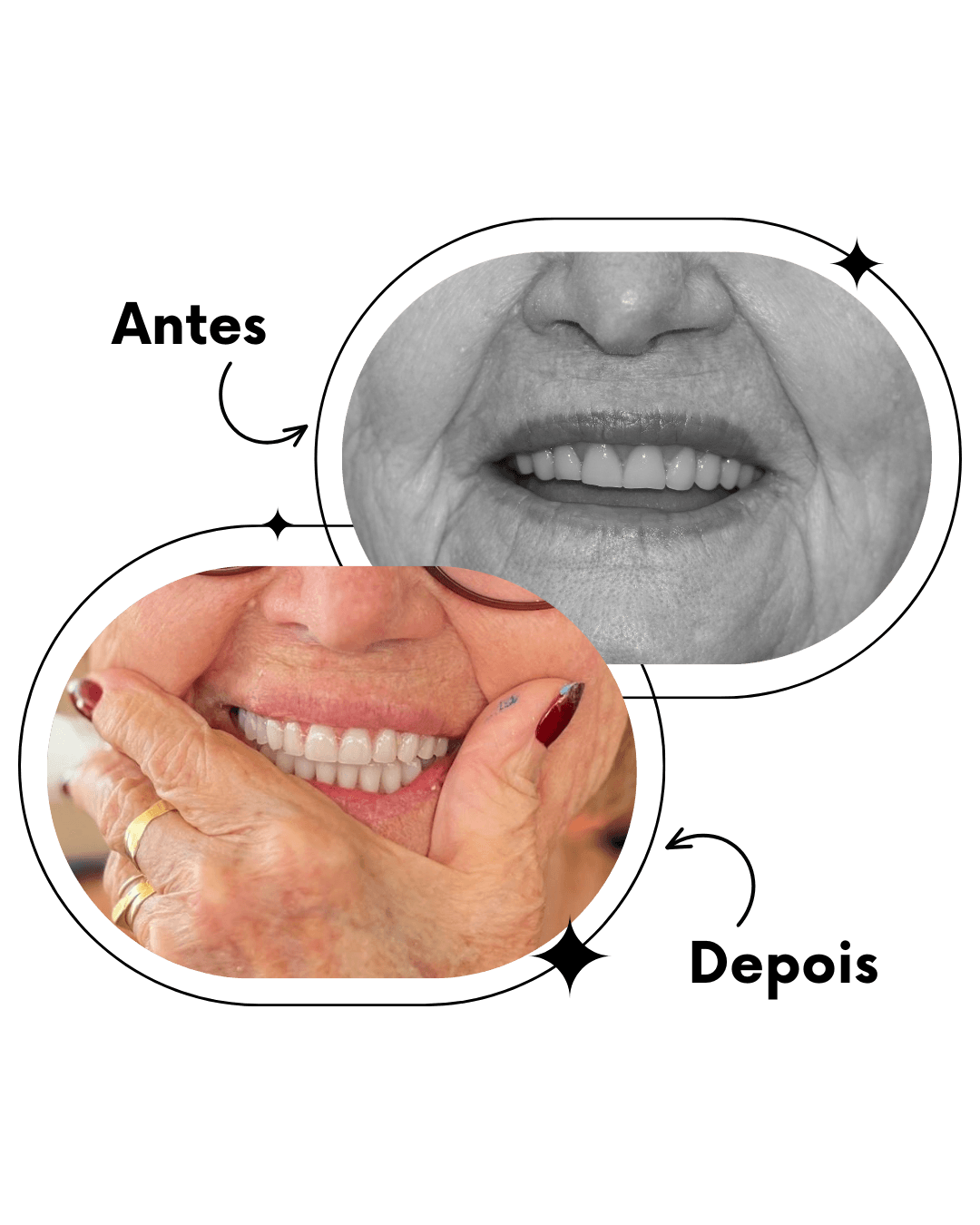 Dentista em Ceilândia realizando implantes dentários