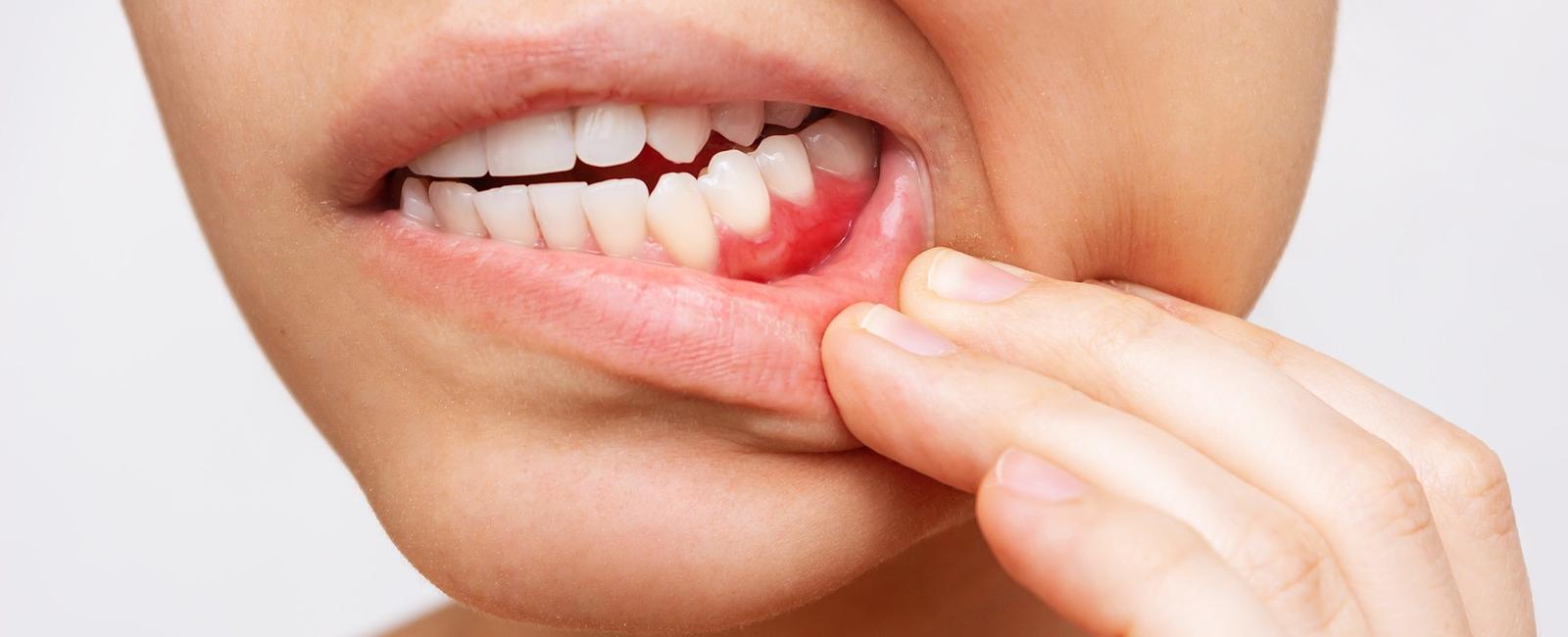 O que fazer quando o paciente não sabe onde está doendo? – Dental