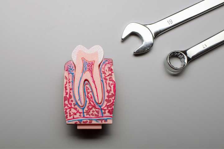 estrutura de um dente