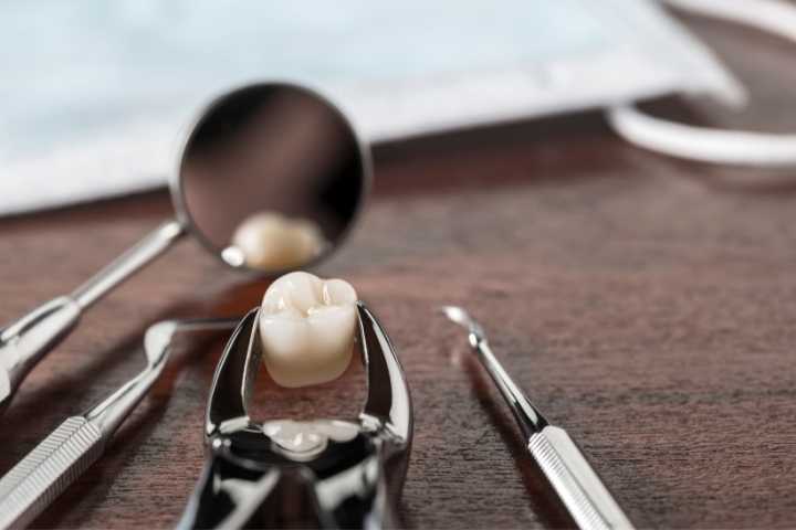 extrair dente siso e perigoso