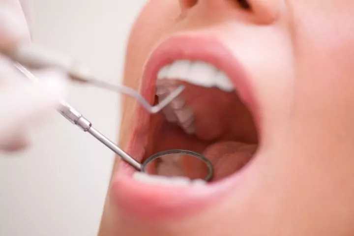 dentista examinando a boca de paciente